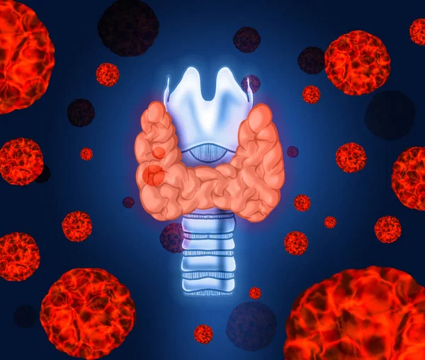 Illustration Human Thyroid Cancer Blue Background — Stock Photo, Image