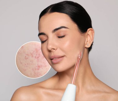 Açık gri arka planda Darsonval kullanan genç kadın