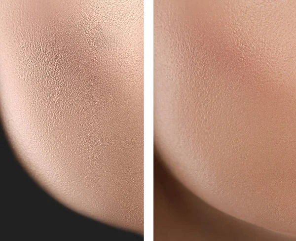 Collage Photos Dry Moisturized Skin Texture — Stock Photo, Image