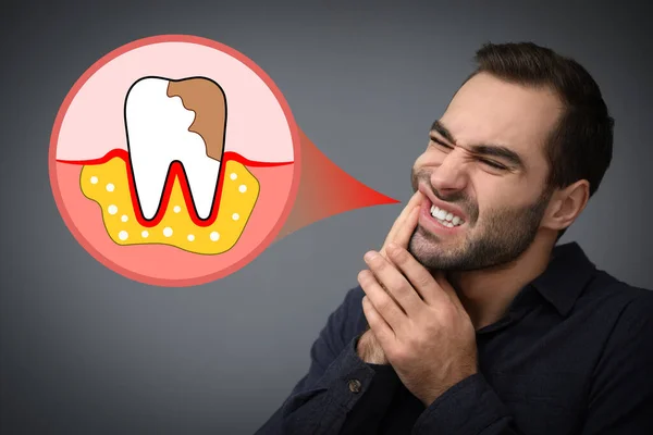 Junger Mann Mit Zahnschmerzen Auf Grauem Hintergrund — Stockfoto
