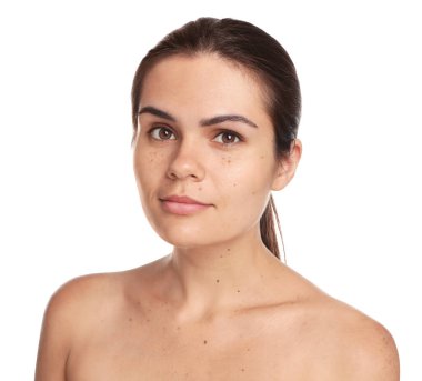 Beyaz arka planda doğum lekeleri olan güzel bir kadın.