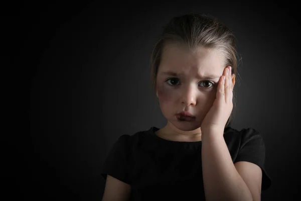 Little girl with bruises on face against dark background, space for text. Domestic violence victim