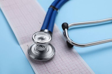 Açık mavi arkaplan üzerine stetoskop ve kardiyogram kağıdı, yakın plan