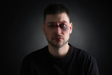 Koyu arkaplanda yüz yaralanması olan adam. Aile içi şiddet mağduru