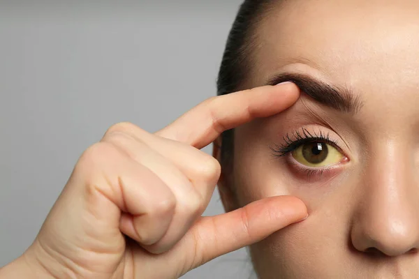 Mulher Verificar Estado Saúde Fundo Cinzento Close Olhos Amarelos Como — Fotografia de Stock