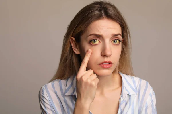 Frau Überprüft Ihren Gesundheitszustand Auf Grauem Hintergrund Gelbe Augen Als — Stockfoto