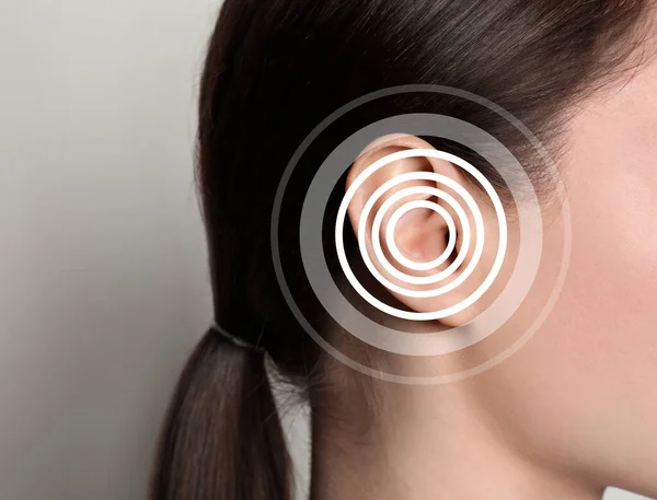 Hearing Loss Concept Woman Sound Waves Illustration Light Background Closeup — Stockfoto