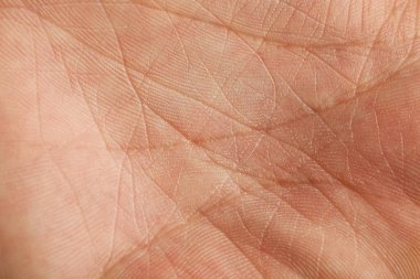 Kuru derili insan avucunun yakın görüntüsü