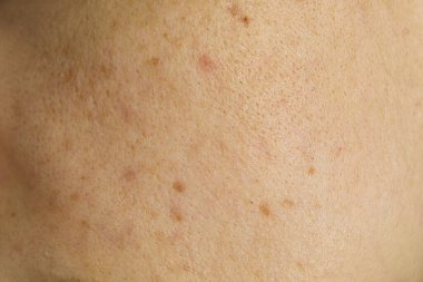 Texture of human skin as background, closeup view
