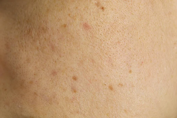 Texture of human skin as background, closeup view