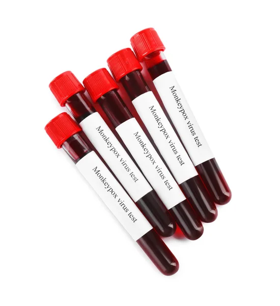 Prueba Del Virus Viruela Tubos Muestra Con Sangre Sobre Fondo —  Fotos de Stock