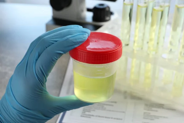 Doctor Holding Container Urine Sample Analysis Grey Table Laboratory Closeup — Stock Photo, Image