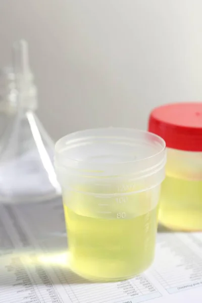 Récipients Avec Échantillons Urine Pour Analyse Verrerie Sur Formulaires Essai — Photo