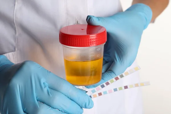 Krankenschwester Hält Teststreifen Und Behälter Mit Urinprobe Zur Analyse Auf — Stockfoto