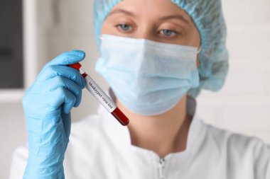 Maymun çiçeği virüsü testi. Laboratuvar çalışanı, elinde kan olan örnek tüpü tutarken, eline odaklan.