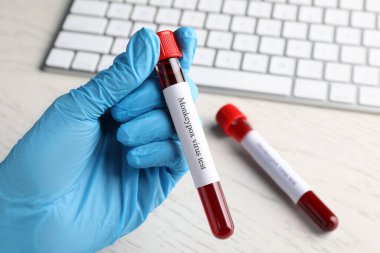 Maymun çiçeği virüsü testi. Laboratuvar çalışanı, üzerinde kan olan örnek tüpü tutuyor. Yakın plan.