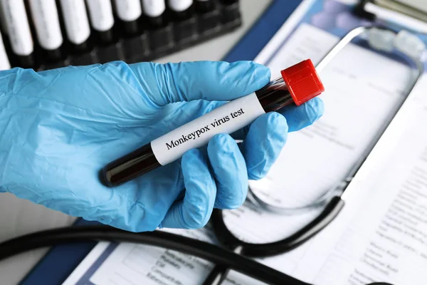 Monkeypox Virus Test Laboratory Worker Holding Sample Tube Blood Table — Stock Photo, Image