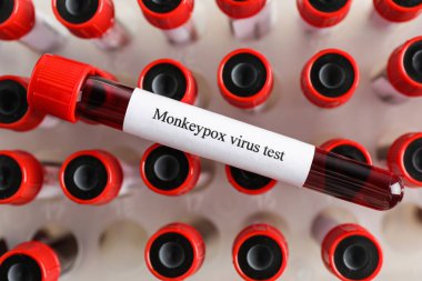 Maymun çiçeği virüsü testi. Diğerlerinin üzerinde kan olan bir örnek tüp, üst görünüm