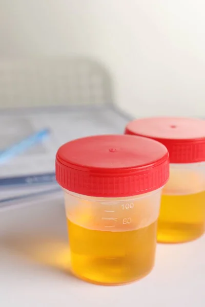 Conteneurs Avec Échantillons Urine Pour Analyse Sur Table Blanche Laboratoire — Photo
