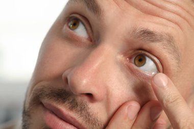 Man putting contact lens in his eye on blurred background, closeup