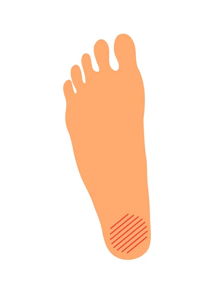 女性の足の上に眼窩部炎の問題 関節と骨の整形外科の変形 女性の足 痛みと癒し 健康管理 白地に孤立したベクトル図 — ストックベクタ