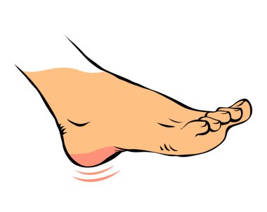 Çizgi, kadın bacağının sorunlu bir resmini çiz. Topuğum ağrıyor. Ortopedik hastalık plantar fasiiti. Ayakların güzelliği ve sağlığı. Resimli el beyaz arkaplanda izole bir şekilde çizildi