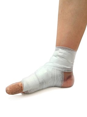 Son zamanlarda işletilen ayak kadın bandaj ile kapatmak