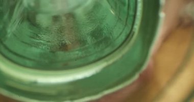 Yakın çekim suyu damara dökülüyor..