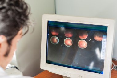 retina taraması seyir