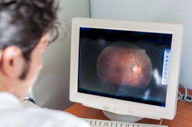 Retina