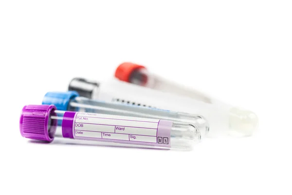 kan örnekleme tüpler