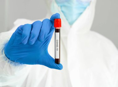 Araştırmacının elinde Covid-19 ile enfekte olmuş bir hastanın kan örneği. Coronavirus hastalığı 2019 Bir laboratuarda test süreci.