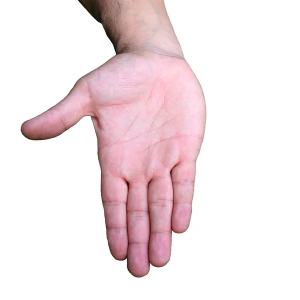 A hand with a lag thumb. — Stock Photo, Image