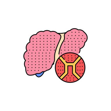 Karaciğer sirozu renk çizgisi simgesi. İnsan hastalıkları. Web sayfası, mobil uygulama, tanıtım için resim grafiği.