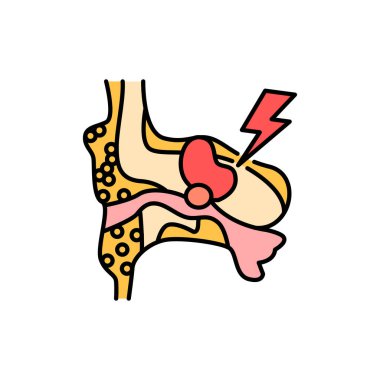 Kolesteatom renk çizgisi simgesi. İnsan hastalıkları. Web sayfası, mobil uygulama, tanıtım için resim grafiği.