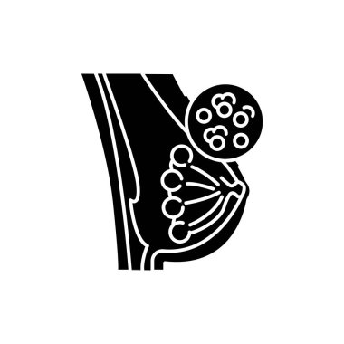 Mastitis renk çizgisi simgesi. İnsan hastalıkları.