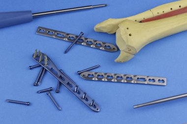 Kemik kırıklarına karşı osteosentez için cerrahi plaka