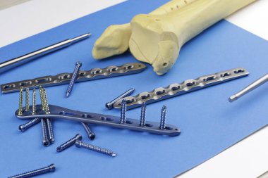 Kemik kırıklarına karşı osteosentez için cerrahi plaka