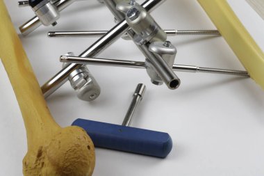 Kemik kırıklarına karşı osteosentez için cerrahi plakalar