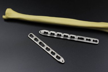 Kemik kırılması durumunda osteosentez için cerrahi plakalar