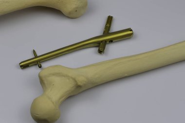 Ameliyat odasındaki kemik kırıklarına karşı osteosentez için cerrahi aletler.