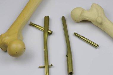 Ameliyat odasındaki kemik kırıklarına karşı osteosentez için cerrahi aletler.