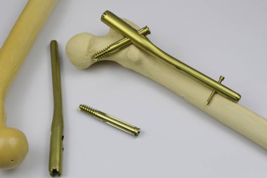 Ameliyat odasındaki kemik kırıklarına karşı osteosentez için cerrahi aletler.