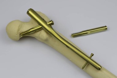 Ameliyat odasındaki kemik kırıklarına karşı osteosentez için cerrahi aletler.