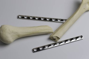 Ameliyat odasındaki kemik kırıklarına karşı osteosentez için cerrahi aletler.