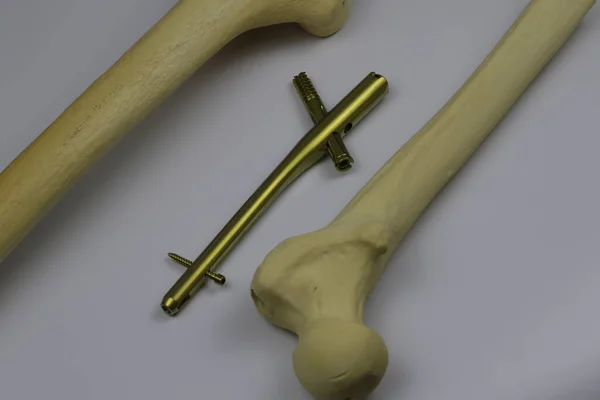 Chirurgické Nástroje Pro Osteosyntézu Případě Zlomenin Kostí Operačním Sále — Stock fotografie