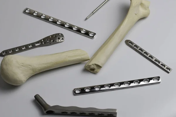Csonttörések Esetén Oszteoszintézis Műtéti Eszközei Műtőben — Stock Fotó