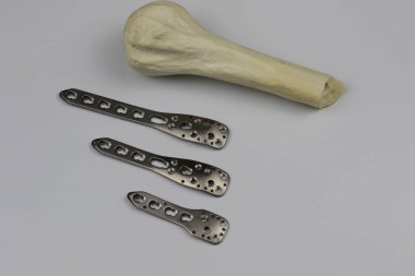 Kemik kırıklarına karşı osteosentez için cerrahi plaka