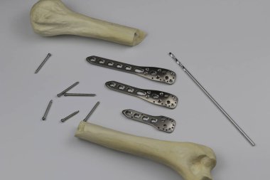 Kemik kırıklarına karşı osteosentez için cerrahi plaka