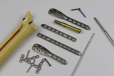 Kemik kırıklarına karşı osteosentez için cerrahi plaka